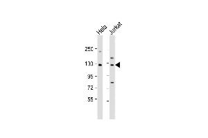 All lanes : Anti-DIS3 Antibody (Center) at 1:1000 dilution Lane 1: Hela whole cell lysate Lane 2: Jurkat whole cell lysate Lysates/proteins at 20 μg per lane. (DIS3 anticorps  (AA 295-323))