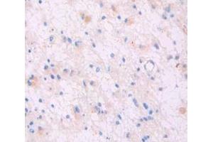 Figure. (Dermcidin anticorps  (AA 18-110))