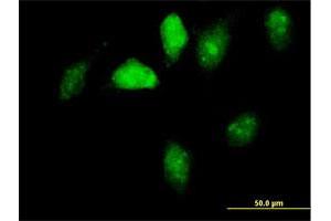 Immunofluorescence of purified MaxPab antibody to GNL1 on HeLa cell. (GNL1 anticorps  (AA 1-607))