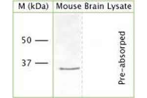 WB on mouse brain lysate (denatured, reduced) using Rabbit antibody to n-terminal region of OLIG2 (Oligo2, bHLHB1, RACK17): IgG (ABIN350657) at a concentration of 30 µg/ml.
