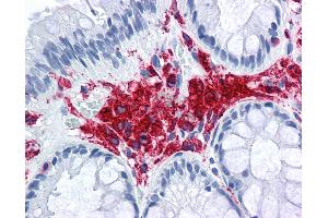 Anti-MHC Class II DQ DR Polymorphic antibody IHC of human colon. (MHC Class II DQ/DR anticorps (FITC))