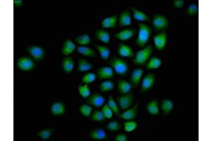 Immunofluorescence staining of Hela cells with ABIN7160643 at 1:133, counter-stained with DAPI. (MTMR2 anticorps  (AA 1-173))