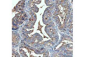IHC analysis of CA125/MUC16 using anti-CA125/MUC16 antibody (ABIN7604184).