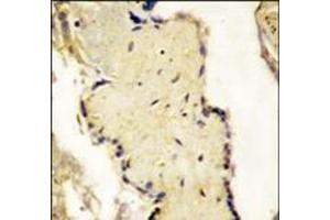 Formalin-fixed and paraffin-embedded placenta tissue reacted with SPPL2a Antibody (N-term), which was peroxidase-conjugated to the secondary antibody, followed by DAB staining. (SPPL2A anticorps  (N-Term))