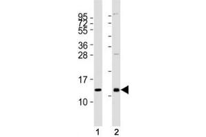 Western blot testing of CXCL12 antibody at 1:2000 dilution.
