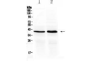 Western blot analysis of OTC using anti- OTC antibody . (OTC anticorps  (N-Term))