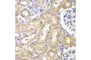 Immunohistochemistry of paraffin-embedded rat liver using HADH antibody at dilution of 1:100 (400x lens). (HADH anticorps)