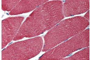 Immunohistochemistry staining of human muscle (paraffin-embedded sections) with anti-muscle-specific actin (HHF35).