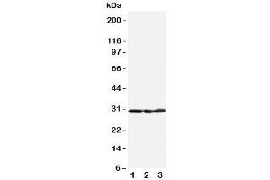 Western blot testing of COMT antibody and Lane 1:  HeLa;  2: A375;  3: PANC cell lysate. (COMT anticorps  (N-Term))