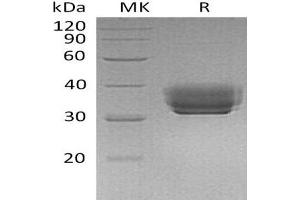 Western Blotting (WB) image for Butyrophilin, Subfamily 1, Member A1 (BTN1A1) protein (His tag) (ABIN7320474)