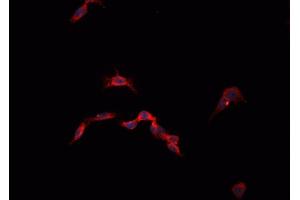 ABIN6268855 staining 293T  cells by IF/ICC. (CysLTR1 anticorps)