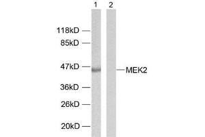 Western blot analysis of extracts from ovary cancer cells using MEK2 (Ab-394) antibody (E021008). (MEK2 anticorps)