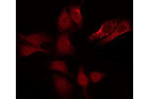 ABIN6267651 staining Hela by IF/ICC. (Caspase 8 anticorps  (pSer347))