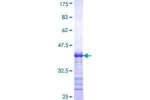 Image no. 1 for Solute Carrier Family 12 (Potassium-Chloride Transporter) Member 6 (SLC12A6) (AA 1-90) protein (GST tag) (ABIN1320131)