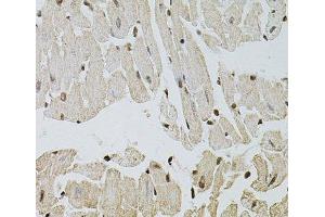 Immunohistochemistry of paraffin-embedded Mouse heart using FGF2 Polyclonal Antibody at dilution of 1:100 (40x lens).