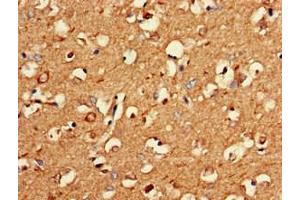 Immunohistochemistry of paraffin-embedded human brain tissue using ABIN7162627 at dilution of 1:100 (PNMA2 anticorps  (AA 2-361))