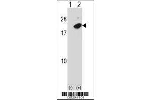 Western blot analysis of NUDT2 using rabbit polyclonal NUDT2 Antibody using 293 cell lysates (2 ug/lane) either nontransfected (Lane 1) or transiently transfected (Lane 2) with the NUDT2 gene.