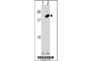 Western blot analysis of NUDT2 using rabbit polyclonal NUDT2 Antibody using 293 cell lysates (2 ug/lane) either nontransfected (Lane 1) or transiently transfected (Lane 2) with the NUDT2 gene. (NUDT2 anticorps  (AA 62-90))