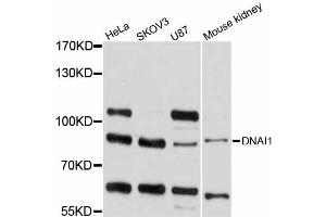 Western blot analysis of extracts of various cell lines, using DNAI1 antibody (ABIN5997592) at 1/1000 dilution.