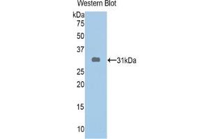Western blot analysis of the recombinant protein. (ABCA1 anticorps  (AA 1404-1663))