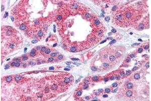 Kidney, Human: Formalin-Fixed, Paraffin-Embedded (FFPE)