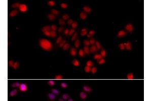 Immunofluorescence analysis of HeLa cells using DNAJB6 Polyclonal Antibody at dilution of 1:100 (40x lens).