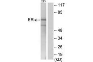 Western blot analysis of extracts from 293 cells, using Estrogen Receptor-alpha (Ab-537) Antibody. (Estrogen Receptor alpha anticorps  (AA 501-550))
