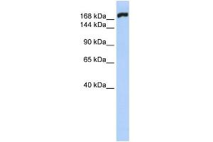 WB Suggested Anti-MYH10 Antibody Titration:  0. (MYH10 anticorps  (N-Term))