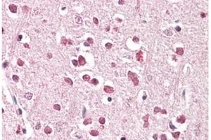Image no. 1 for anti-XPA Binding Protein 2 (XAB2) (C-Term) antibody (ABIN374084) (XAB2 anticorps  (C-Term))