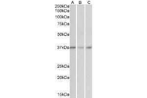 ABIN571105 (0. (GHITM anticorps  (Internal Region))