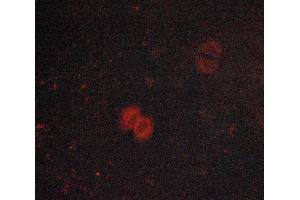 ABIN6267072 staining lovo cells by ICC/IF.