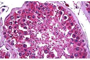 Human Testis: Formalin-Fixed, Paraffin-Embedded (FFPE) (PDK2 anticorps  (AA 187-276))
