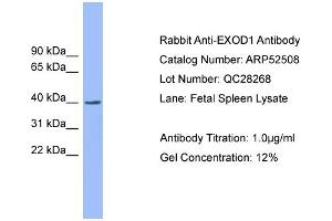WB Suggested Anti-EXOD1  Antibody Titration: 0. (ERI2 anticorps  (N-Term))