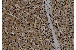 ABIN6263929 and ABIN6273282 at 1/100 staining Human liver tissue by IHC-P. (p107 anticorps  (C-Term))