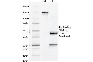 SDS-PAGE Analysis Purified CD61 Monoclonal Antibody (Y2/51). (Integrin beta 3 anticorps)