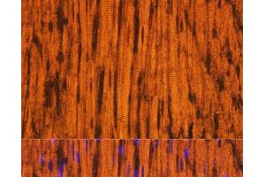 Immunofluorescence analysis of Rat heart using MYH6 Polyclonal Antibody at dilution of 1:100.