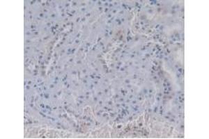 IHC-P analysis of Rat Kidney Tissue, with DAB staining. (Prothrombin anticorps  (AA 201-323))
