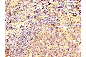 IHC image of ABIN7149787 diluted at 1:500 and staining in paraffin-embedded human tonsil tissue performed on a Leica BondTM system. (Desmoglein 3 anticorps  (AA 70-615))