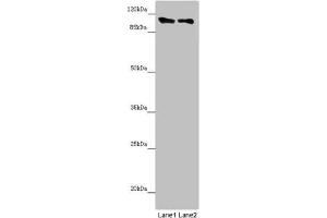 Western blot All lanes: DDX11 antibody at 8. (DDX11 anticorps  (AA 1-220))