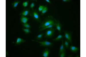 Immunofluorescence staining of Hela cells with ABIN7157599 at 1:200, counter-stained with DAPI. (KIF15 anticorps  (AA 1-129))