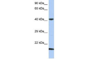 WB Suggested Anti-SEC14L4 Antibody Titration: 0. (SEC14L4 anticorps  (N-Term))