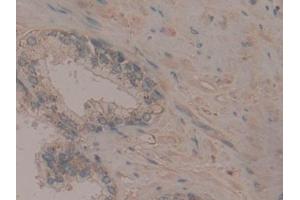 Detection of Flt3 in Human Prostate Tissue using Polyclonal Antibody to FMS Like Tyrosine Kinase 3 (Flt3)
