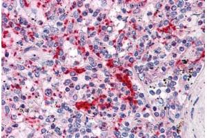 Human Spleen: Formalin-Fixed, Paraffin-Embedded (FFPE) (TLN1 anticorps  (AA 1052-1150))