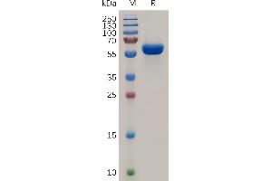Human TNFA Protein, hFc Tag on SDS-PAGE under reducing condition.