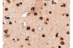 Immunohistochemistry (IHC) image for anti-Regulating Synaptic Membrane Exocytosis 3 (RIMS3) (N-Term) antibody (ABIN1031542) (RIMS3 anticorps  (N-Term))