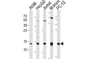 Western blot analysis of lysates from A549, HepG2, Jurkat cell line, mouse brain tissue lysate, rat PC-12 cell line (from left to right), using ATP5D Antibody (C-term) (ABIN6242954 and ABIN6577658). (ATP5F1D anticorps  (C-Term))