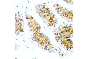 Immunohistochemistry of paraffin-embedded human stomach using SIRT1 antibody at dilution of 1:100 (40x lens). (SIRT1 anticorps  (C-Term))