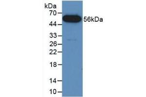 Detection of Recombinant FUS, Mouse using Polyclonal Antibody to Fusion (FUS) (Fusion (FUS) (AA 3-267) anticorps)