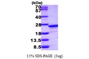 SDS-PAGE (SDS) image for Transgelin 2 (TAGLN2) (AA 13-199) protein (His tag) (ABIN667368)