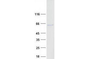 Validation with Western Blot